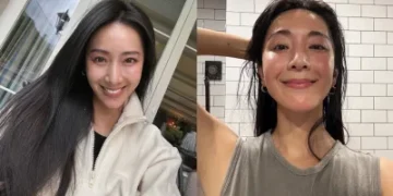 45歲隋棠大方認了做醫美!曬電波術後「真面目素顏照」