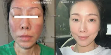 KIMIKO消失2週驚曝「鬼門關走一遭」！全身紅腫險昏厥