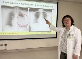 社會新鮮人求職健檢驚見15公分巨大腫瘤　胸腔鏡手術發現竟是畸胎瘤